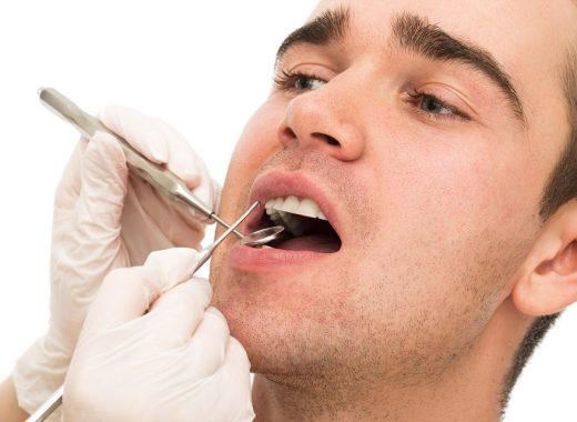 Dental Problems