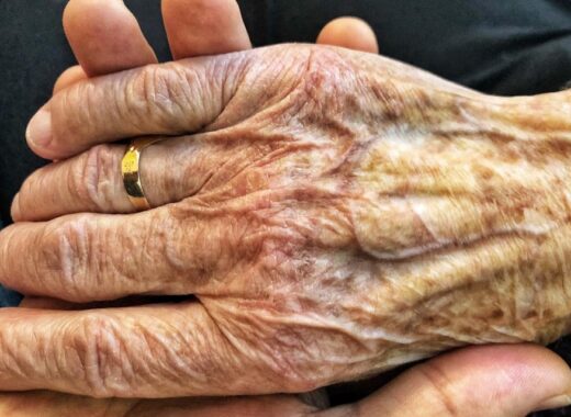 Parkinson’s Disease