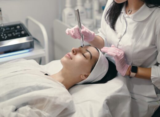 Microneedling Can Help Reduce Acne Scars And Hyperpigmentation